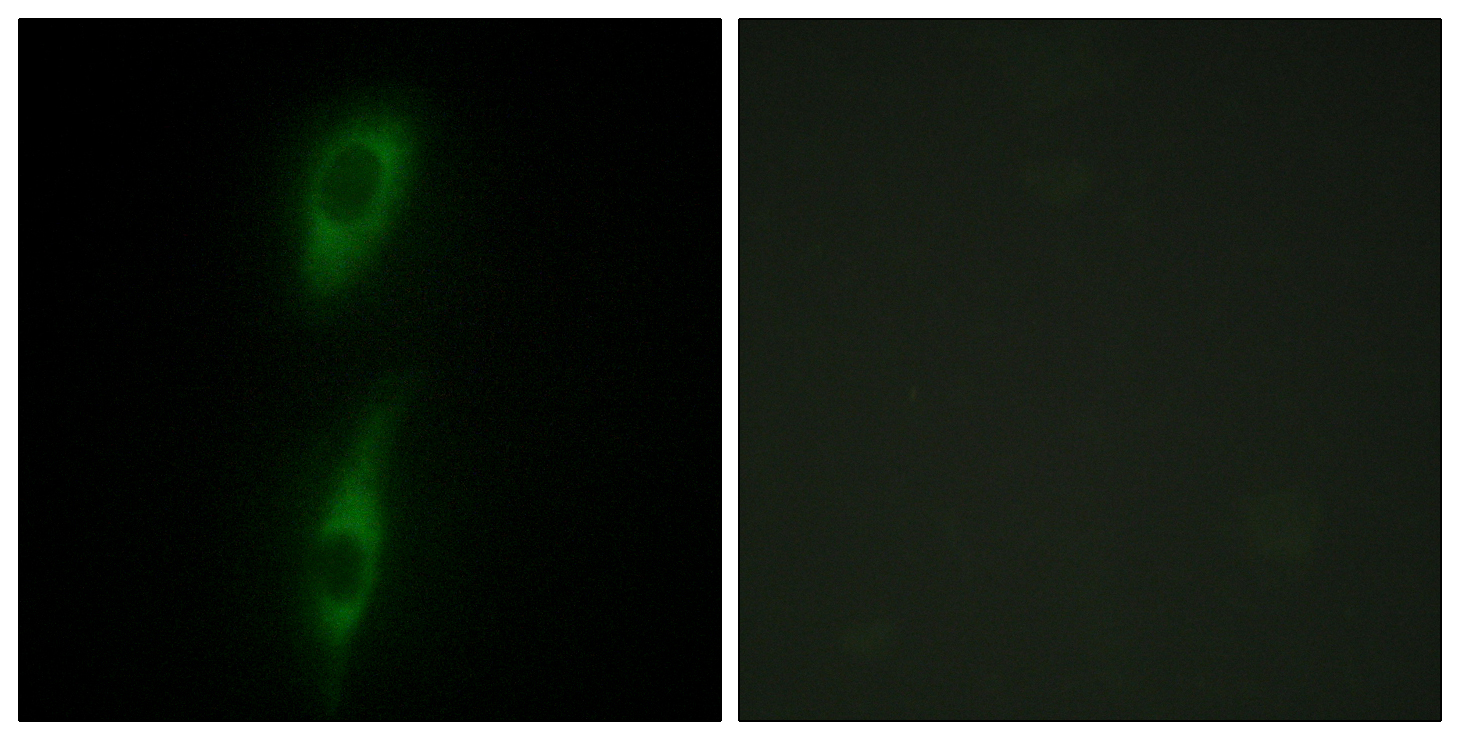 Anti-ACVL1 Antibody Anti-ACVL1 Antibody