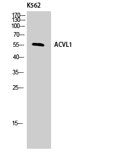 Anti-ACVL1 Antibody Anti-ACVL1 Antibody