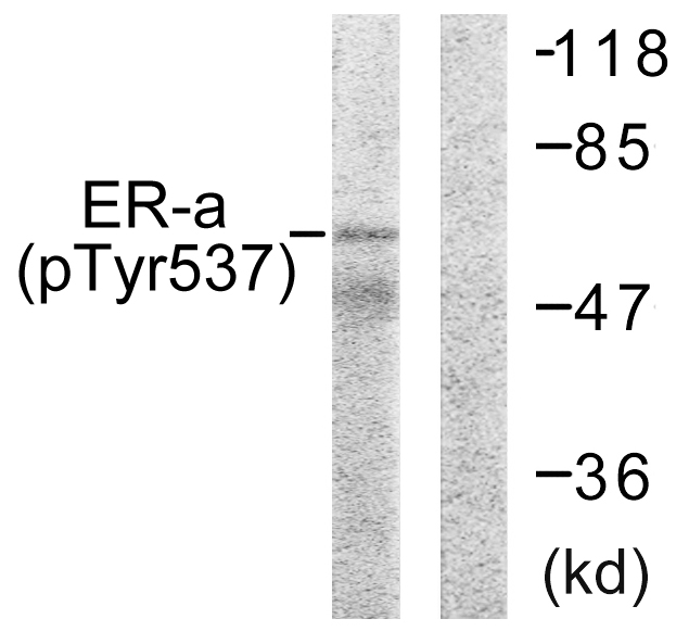 Anti-Estrogen Receptor-alpha (phospho Tyr537) Antibody