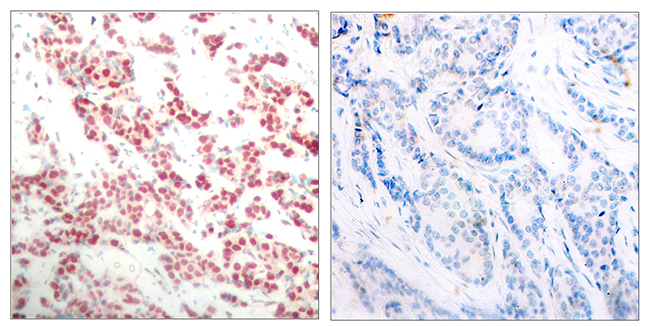 Anti-NF kappa B p100 / p52 (phospho Ser865) Antibody - Identical to Abcam (ab31474)