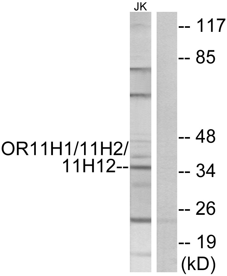 Anti-OR11H1 + OR11H2 + OR11H12 Antibody