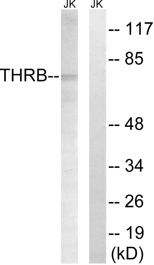 Anti-THRB (AP2,cleaved Arg327) Antibody