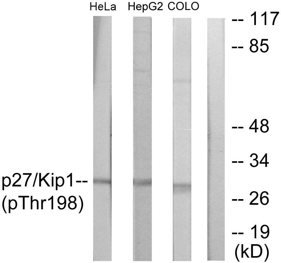 Anti-p27 Kip1 (phospho Thr198) Antibody