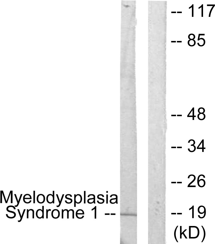 Anti-Myelodysplasia Syndrome 1 Antibody