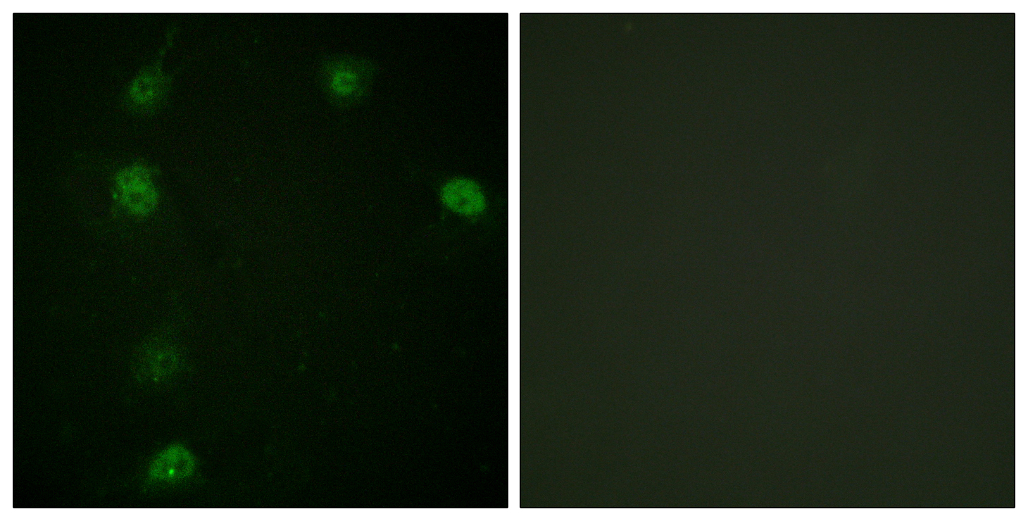 Anti-Cyclin E1 (phospho Thr77) Antibody