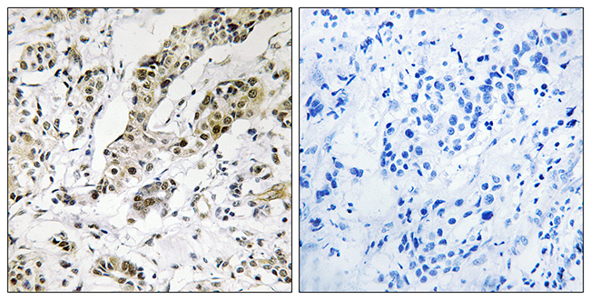 Anti-TCEAL3 + TCEAL5 + TCEAL6 Antibody