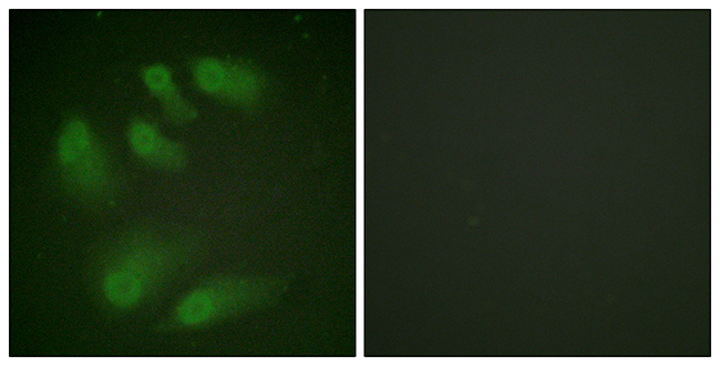 Anti-Chk1 (phospho Ser286) Antibody