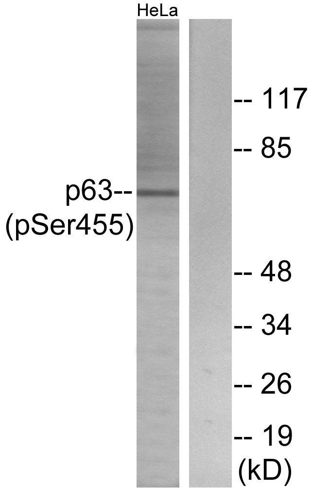 Anti-p63 (phospho Ser455) Antibody