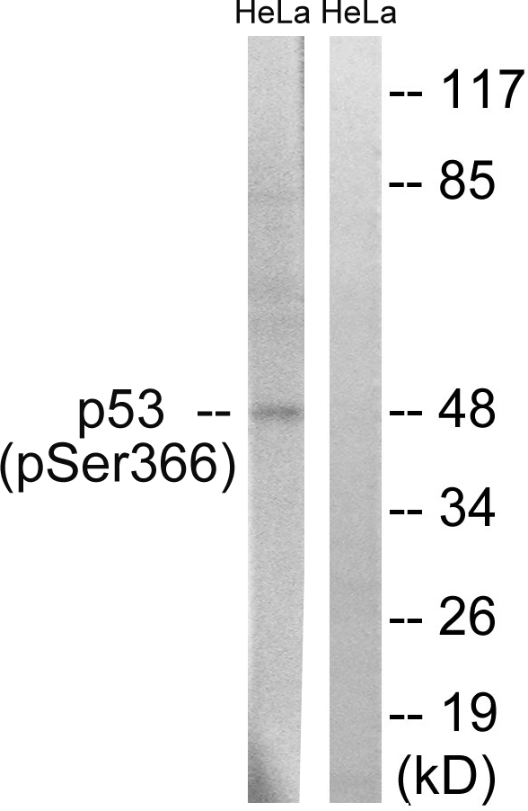 Anti-p53 (phospho Ser366) Antibody