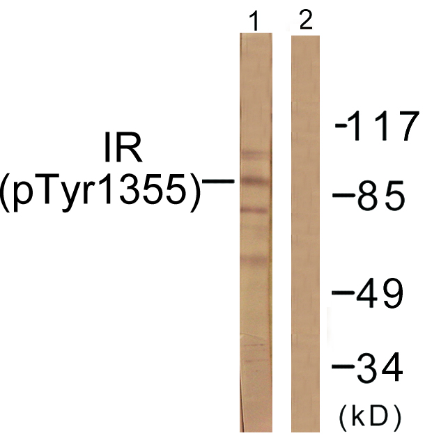 Anti-IR (phospho Tyr1355) Antibody
