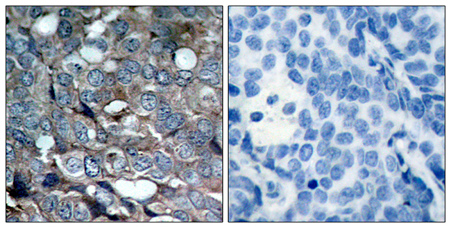 Anti-ASK1 (phospho Ser83) Antibody - Identical to Abcam (ab47304) Anti-ASK1 (phospho Ser83) Antibody - Identical to Abcam (ab47304)