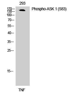Anti-ASK1 (phospho Ser83) Antibody - Identical to Abcam (ab47304) Anti-ASK1 (phospho Ser83) Antibody - Identical to Abcam (ab47304)