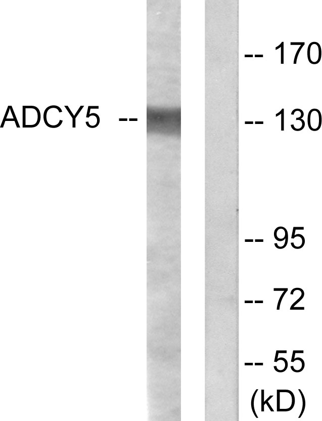 Anti-ADCY5 + ADCY6 Antibody