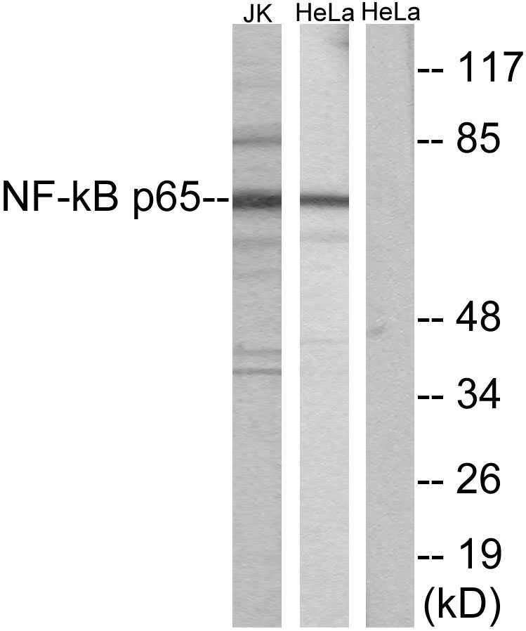 Anti-NF-kappaB p65 Antibody - Identical to Sigma (SAB4502608)