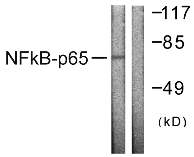 Anti-NF-kappaB p65 Antibody - Identical to Sigma (SAB4502607)