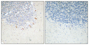 Anti-GABAA Rbeta2 Antibody Anti-GABAA Rbeta2 Antibody