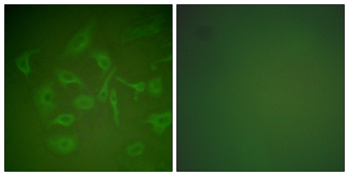Anti-Mammaglobin Antibody
