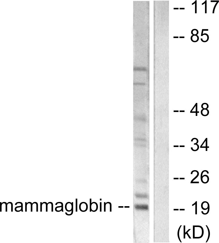 Anti-Mammaglobin Antibody Anti-Mammaglobin Antibody