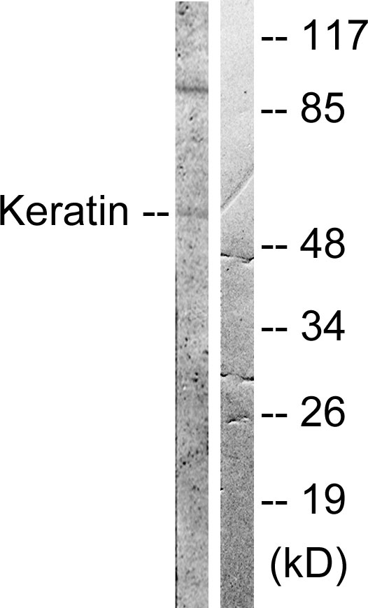 Anti-Keratin 8 Antibody