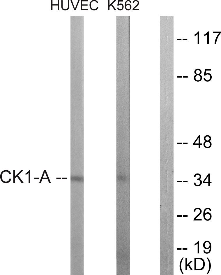 Anti-CKI-alpha Antibody