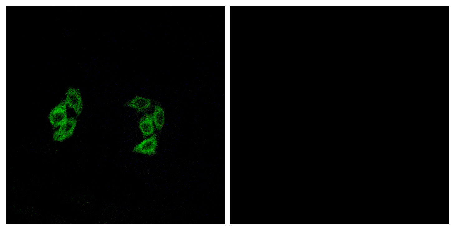 Anti-CSNK1A1L Antibody