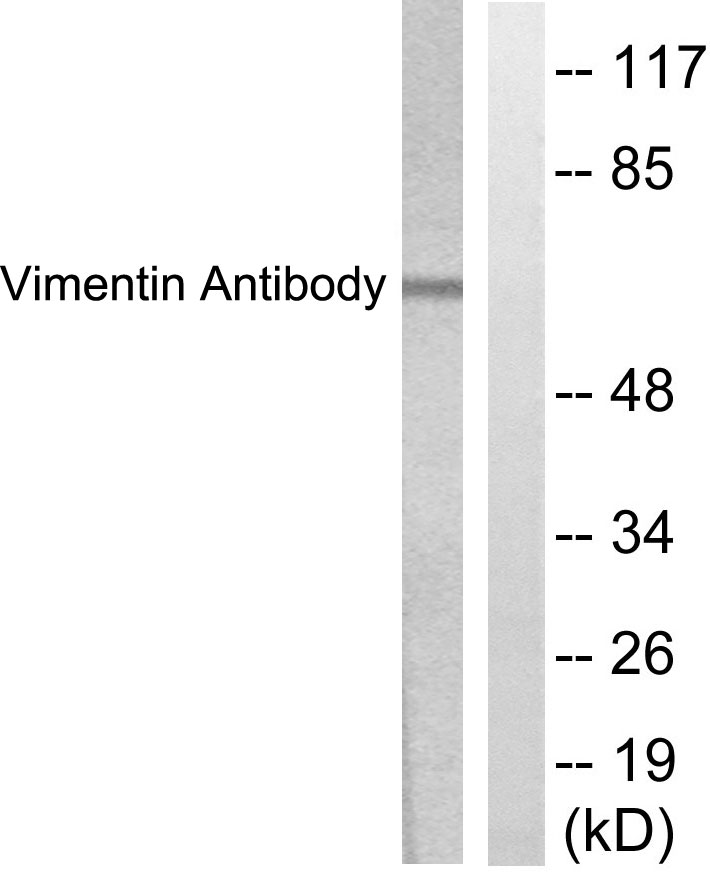 Anti-Vimentin Antibody