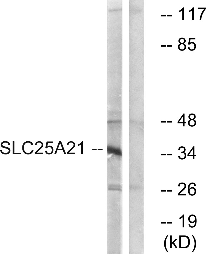 Anti-SLC25A21 Antibody