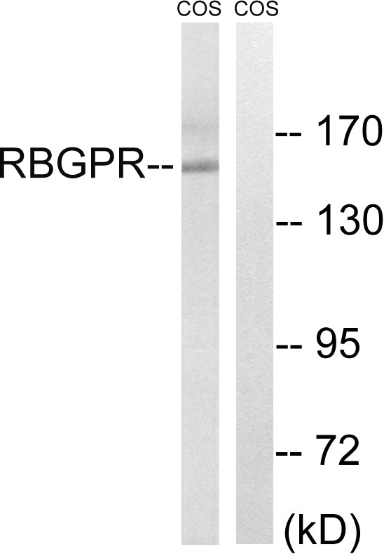 Anti-RAB3GAP2 Antibody - Identical to Abcam (ab110462)