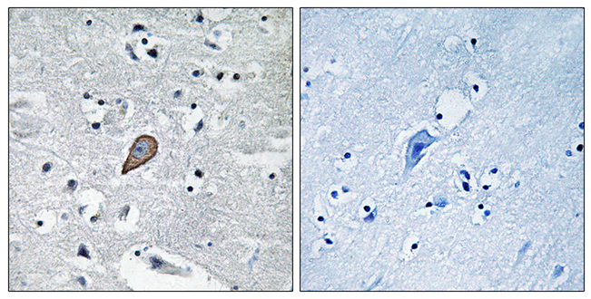 Anti-PKC thet Antibody
