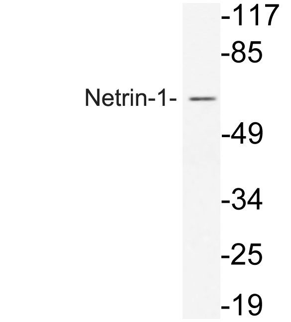 Anti-Netrin-1 Antibody