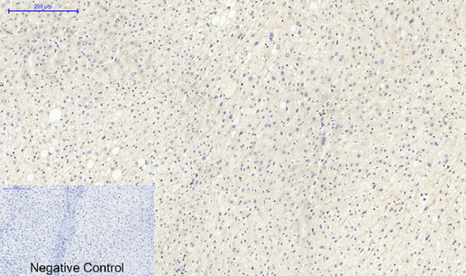 Anti-Lamin B1 Antibody Anti-Lamin B1 Antibody