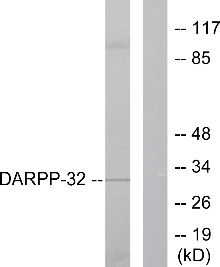 Anti-DARPP-32 Antibody