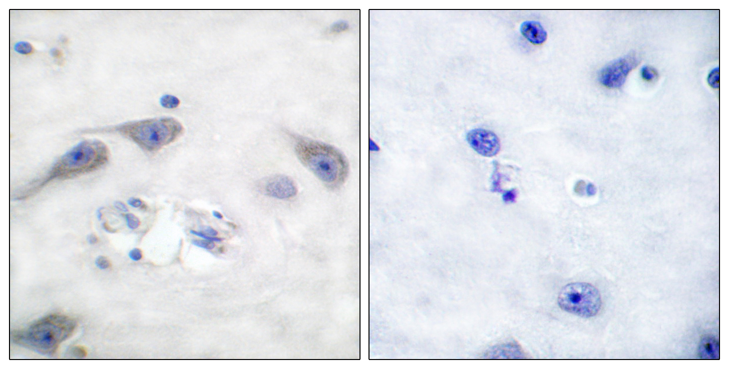 Anti-DARPP-32 Antibody Anti-DARPP-32 Antibody