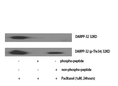 Anti-DARPP-32 Antibody Anti-DARPP-32 Antibody