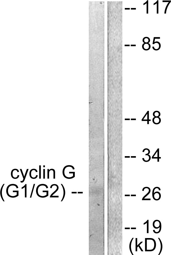 Anti-Cyclin G Antibody