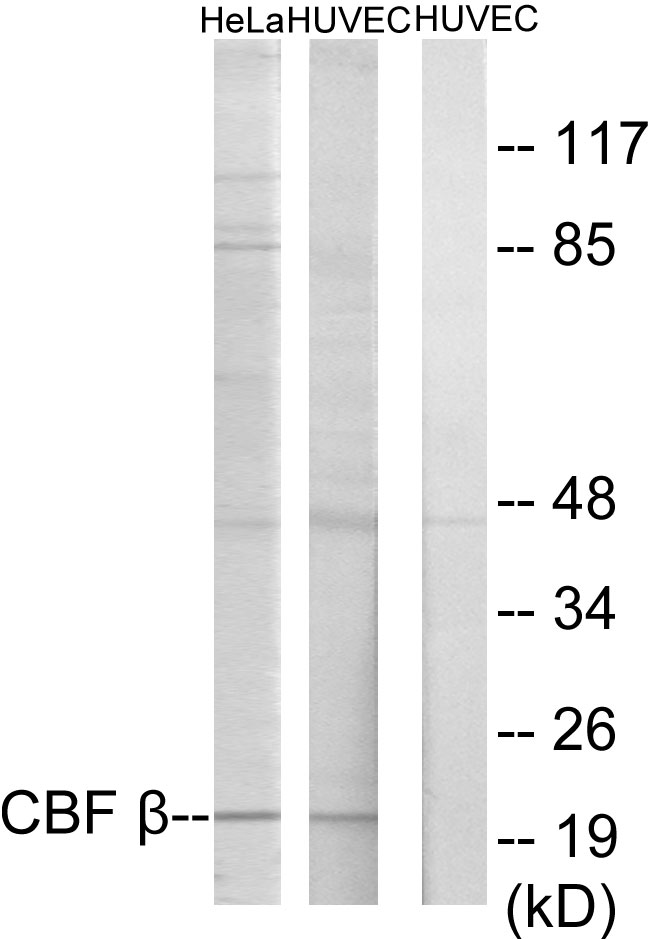 Anti-CBF beta Antibody