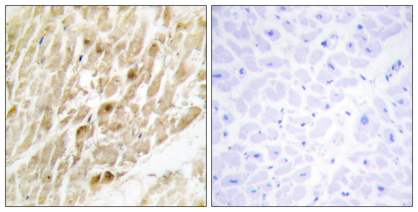 Anti-CBF beta Antibody Anti-CBF beta Antibody