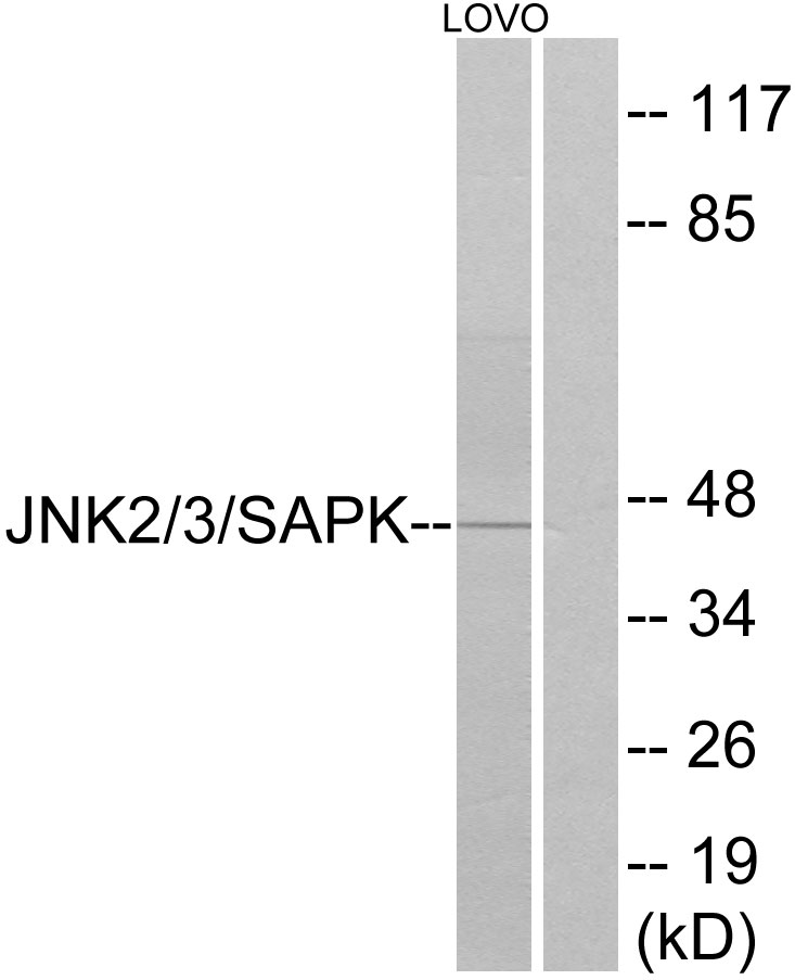 Anti-SAPK Antibody