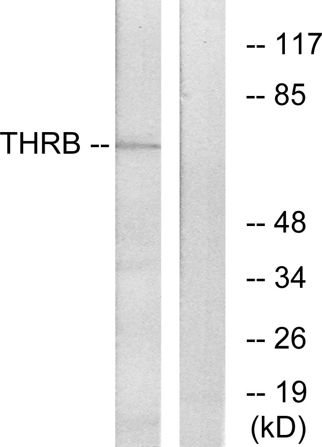 Anti-THRB Antibody