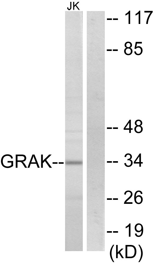 Anti-GRAK Antibody