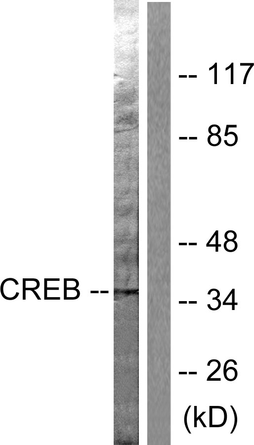 Anti-CREB Antibody