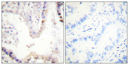 Anti-CREB Antibody Anti-CREB Antibody