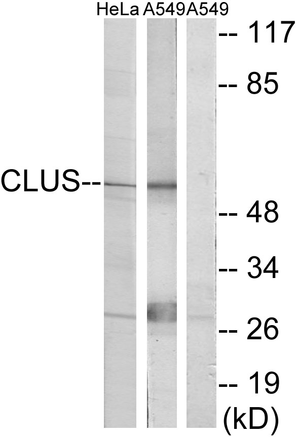 Anti-CLUS Antibody - Identical to Abcam (ab69644)
