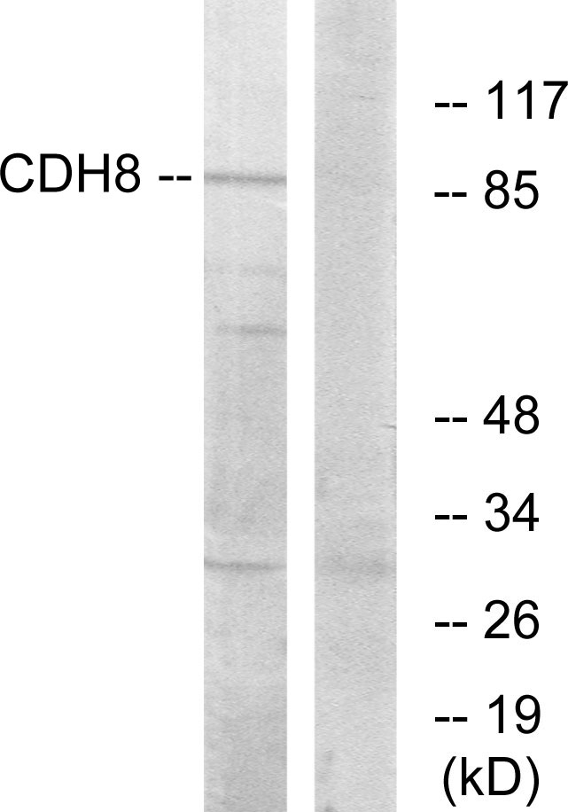 Anti-CDH8 Antibody