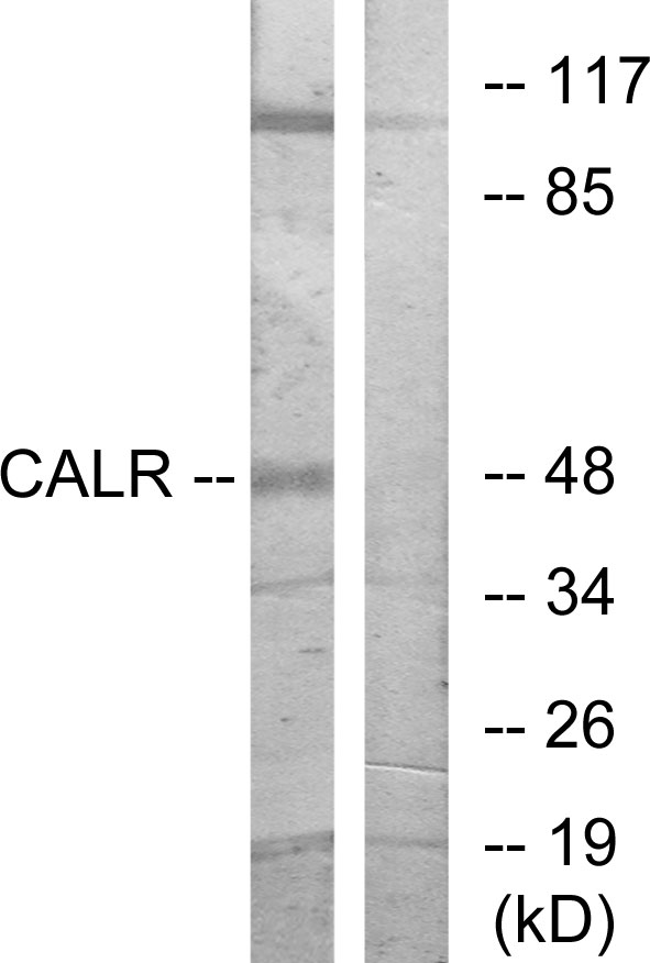 Anti-CALR Antibody