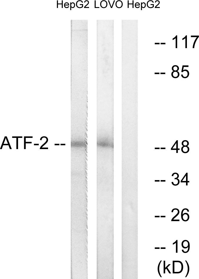 Anti-ATF2 Antibody Anti-ATF2 Antibody