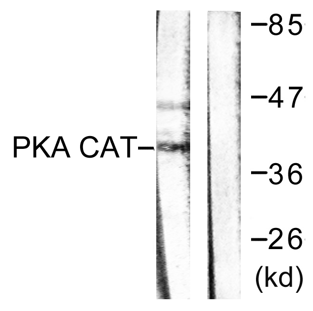 Anti-PKA alpha + beta (catalytic subunits) Antibody