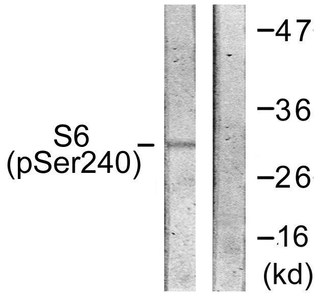 Anti-S6 Ribosomal Protein (phospho Ser240) Antibody Anti-S6 Ribosomal Protein (phospho Ser240) Antibody