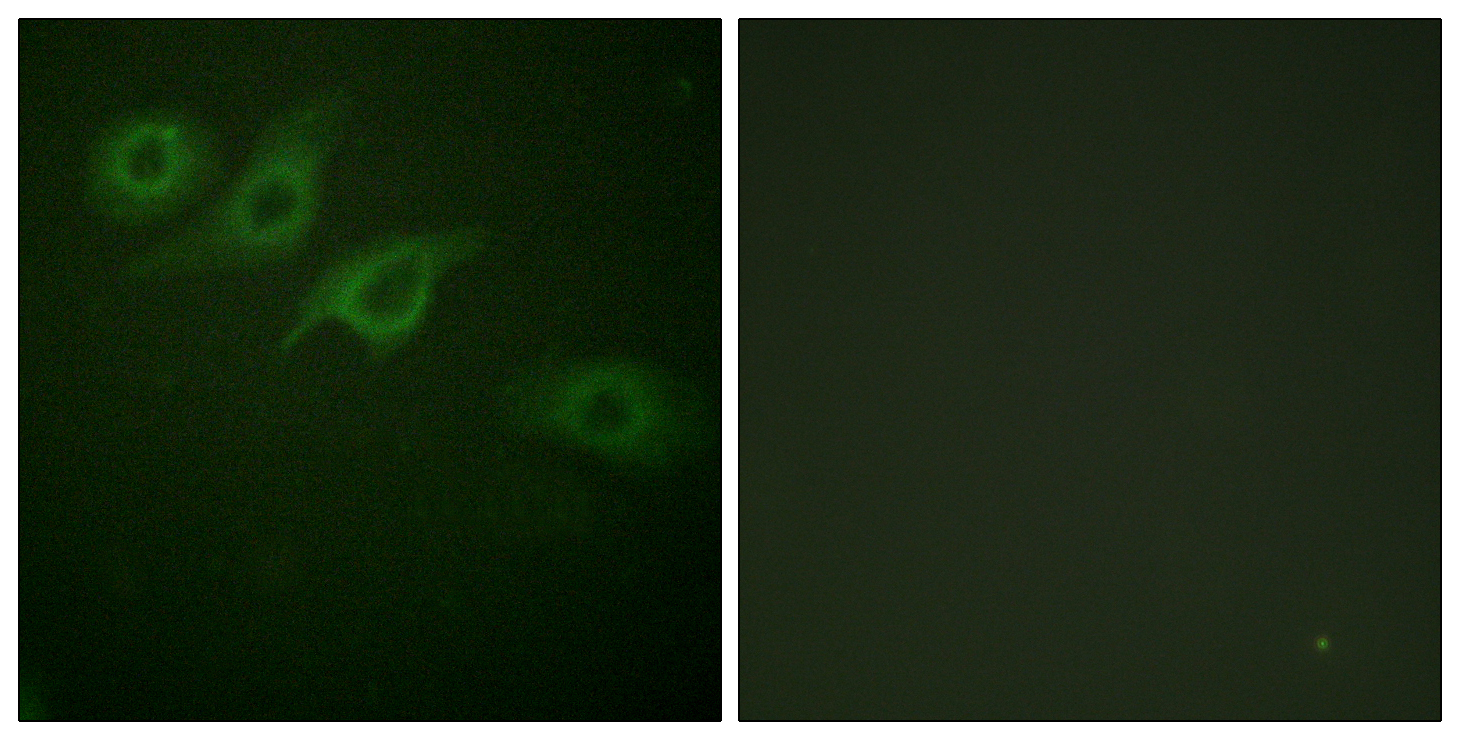 Anti-Interferon-gamma Receptor alpha chain Antibody