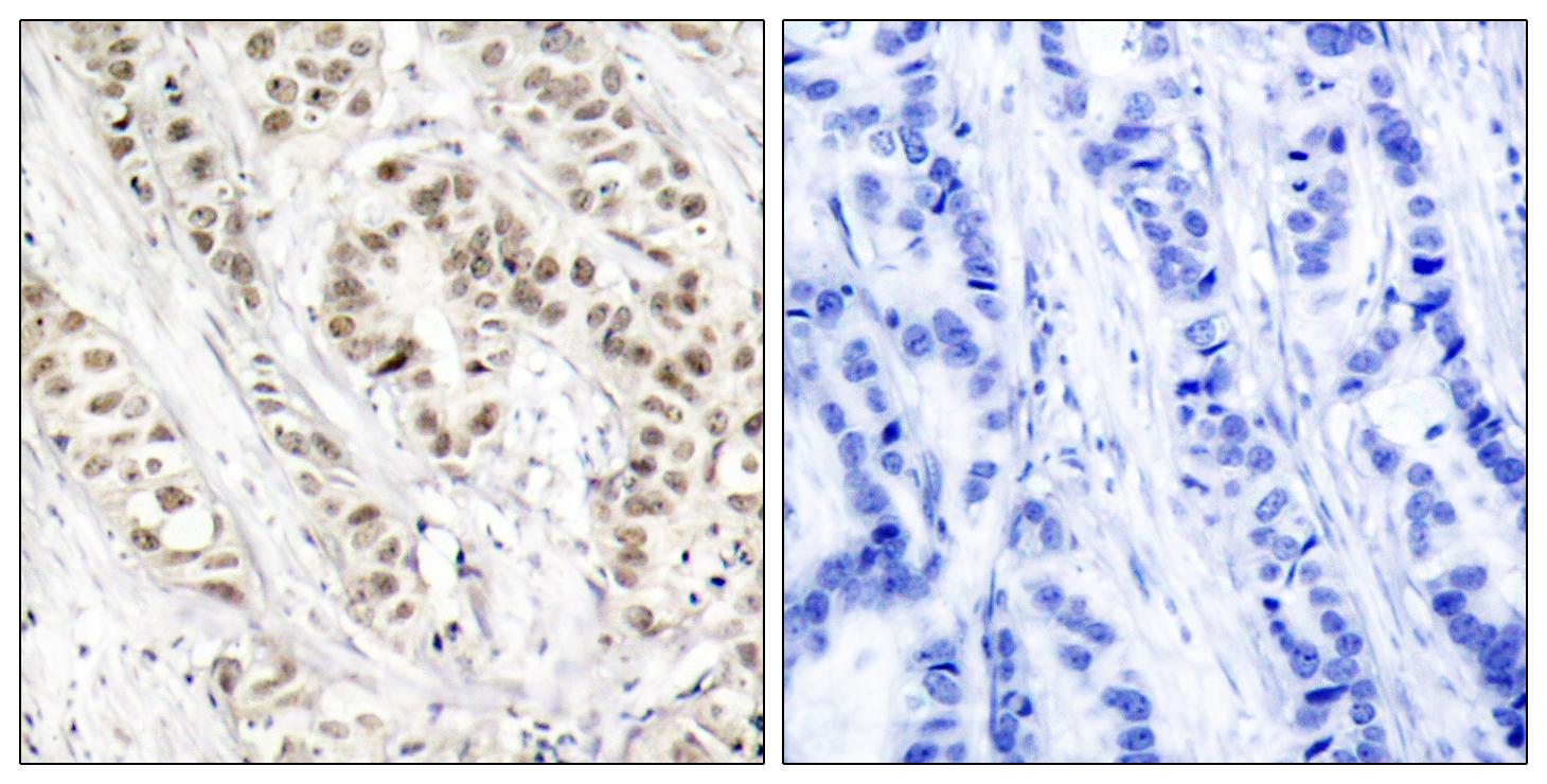 Anti-BRCA1 (phospho Ser1524) Antibody